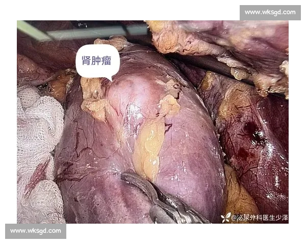 从肾癌病房到商业帝国：韦德如何用三重身份重塑人生